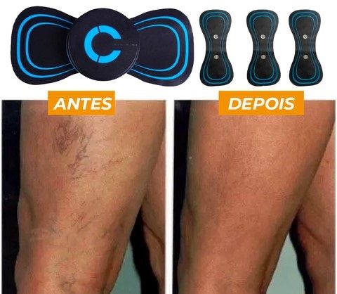 Redutor De Varizes Feminino Elétrico Sem Dor - VariLex