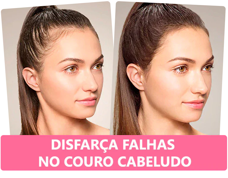 Queratina em Pó para Cobertura de Falhas no Cabelo Sevich™